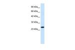 RGS13 Antibody in Western Blot (WB)