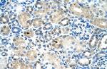 IER2 Polyclonal Antibody