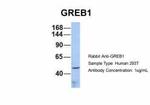 GREB1 Antibody in Western Blot (WB)