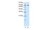 ILF1 Antibody in Western Blot (WB)