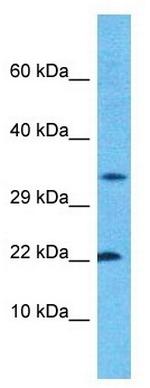 CROC4 Polyclonal Antibody