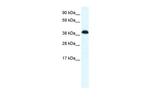 ZNF568 Antibody in Western Blot (WB)