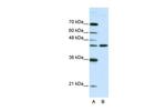 NMUR2 Polyclonal Antibody