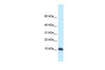MED21 Polyclonal Antibody