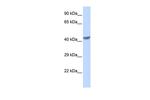 ZNF271 Polyclonal Antibody