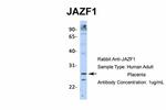 JAZF1 Polyclonal Antibody
