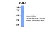 GJA9 Antibody in Western Blot (WB)