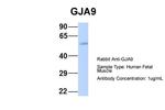 GJA9 Polyclonal Antibody