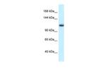 MCM10 Polyclonal Antibody