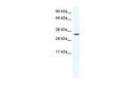 HOXB1 Polyclonal Antibody