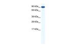 ZFY1 Polyclonal Antibody