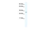 APE1 Polyclonal Antibody