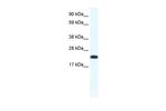CITED4 Polyclonal Antibody