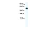 MPND Polyclonal Antibody