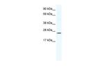 BRF1 Polyclonal Antibody