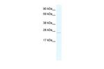 TCF23 Polyclonal Antibody