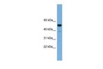 ONECUT3 Polyclonal Antibody