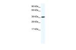 OBOX6 Polyclonal Antibody