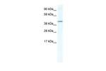 NR1H5 Polyclonal Antibody