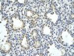 ZNF264 Polyclonal Antibody