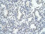 ZNF264 Polyclonal Antibody