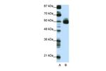 CIR1 Polyclonal Antibody