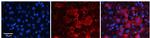 ZNF142 Polyclonal Antibody