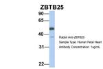 ZBTB25 Polyclonal Antibody