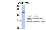 ZBTB25 Antibody in Western Blot (WB)