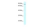 CNOT3 Polyclonal Antibody