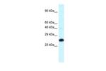 HOXB9 Antibody in Western Blot (WB)