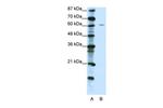 ZNF286A Polyclonal Antibody