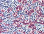 ZNF71 Antibody in Immunohistochemistry (Paraffin) (IHC (P))