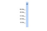 ZNF644 Polyclonal Antibody