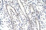 ZNF296 Antibody in Immunohistochemistry (IHC)