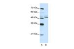 ZNF296 Antibody in Western Blot (WB)