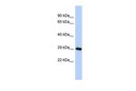 ZNF524 Antibody in Western Blot (WB)