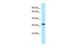 DLX1 Polyclonal Antibody