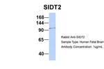 SIDT2 Polyclonal Antibody