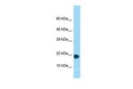 RPL32 Polyclonal Antibody