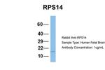 RPS14 Polyclonal Antibody
