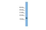 LSM8 Polyclonal Antibody