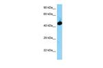 EVL Polyclonal Antibody