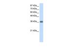 KLHDC8A Polyclonal Antibody