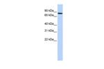 ADARB2 Polyclonal Antibody