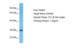 EXOSC5 Polyclonal Antibody