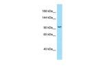 RBM25 Polyclonal Antibody