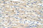 EXOSC6 Polyclonal Antibody