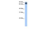ADAD2 Polyclonal Antibody