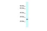 DPT Polyclonal Antibody